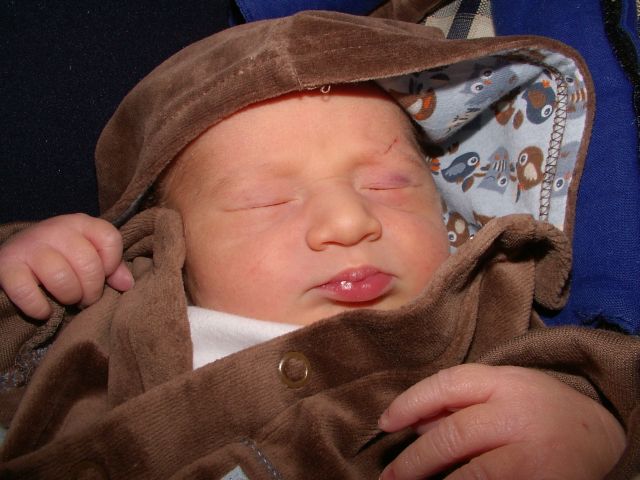 Vágás, monokli, fiú...